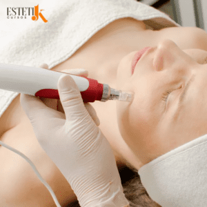 EstétikCursos: Microagulhamento Skinbooster