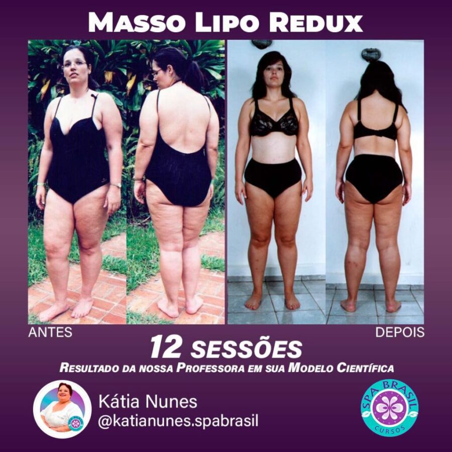 Masso Lipo Reduz é bom