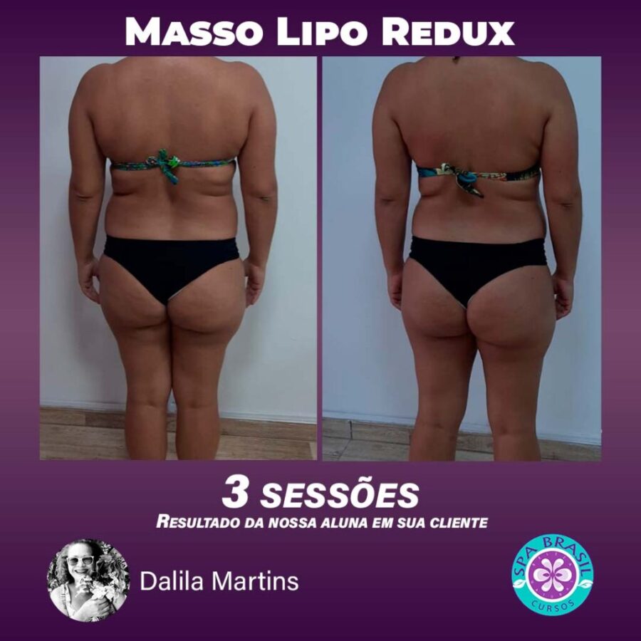 Masso Lipo Reduz funciona