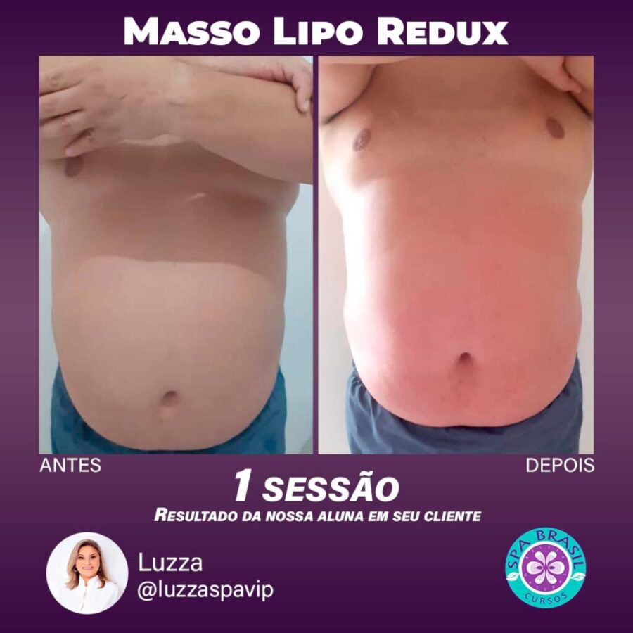 Masso Lipo Reduz é bom