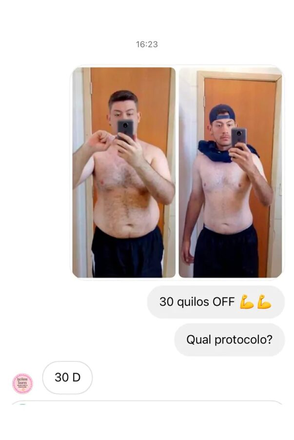 Protocolo 30D versão 2.0 Dr Osvaldo resultado antes e depois